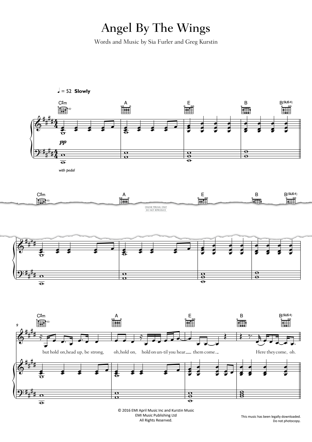 Product gallery: Page 1 of 1 Angel By The Wings, Sia