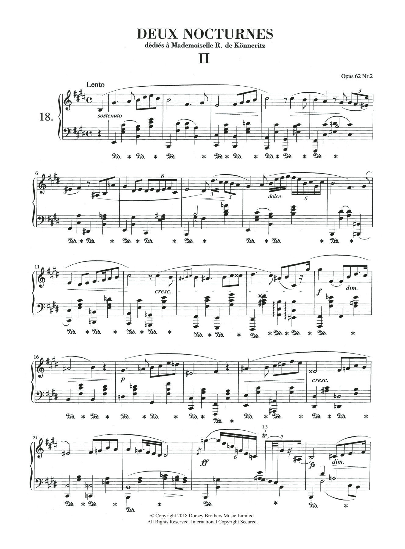 Product picture to: Nocturne in E Major, Op.62, No.2
