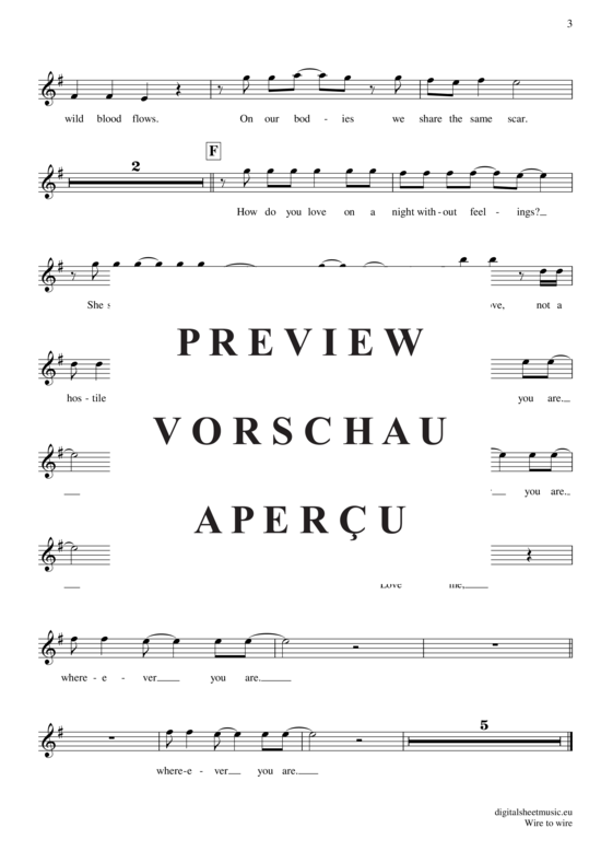 Product gallery: Page 4 of 4 Wire to wire , Razorlight, Clarinet in B-flat