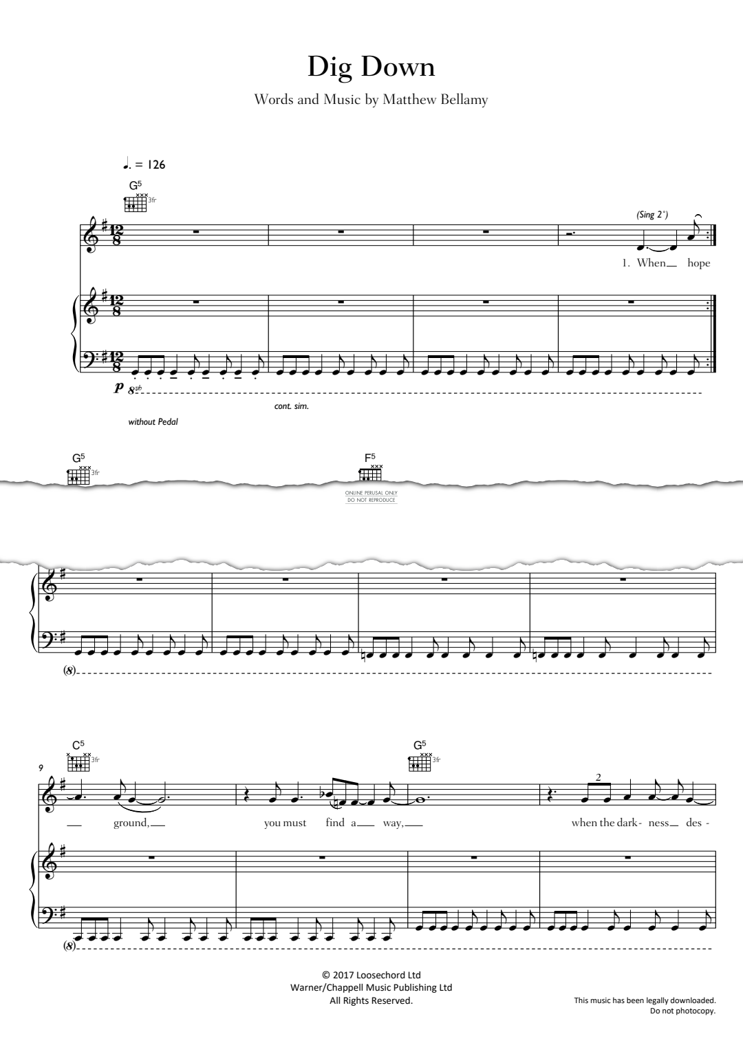 Product gallery: Page 1 of 1 Dig Down, Muse