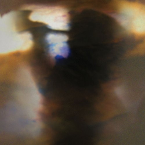 cover: What Would I Want? Sky, Animal Collective