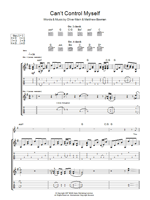 Produktgalerie: Seite 1 von 1 I Can't Control Myself, The Pigeon Detectives, Gitarre