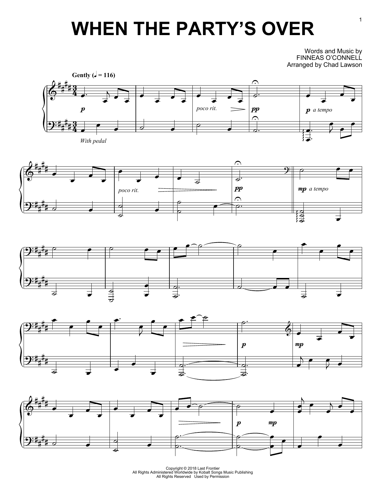 Produktbild zu: when the party's over (arr. Chad Lawson)