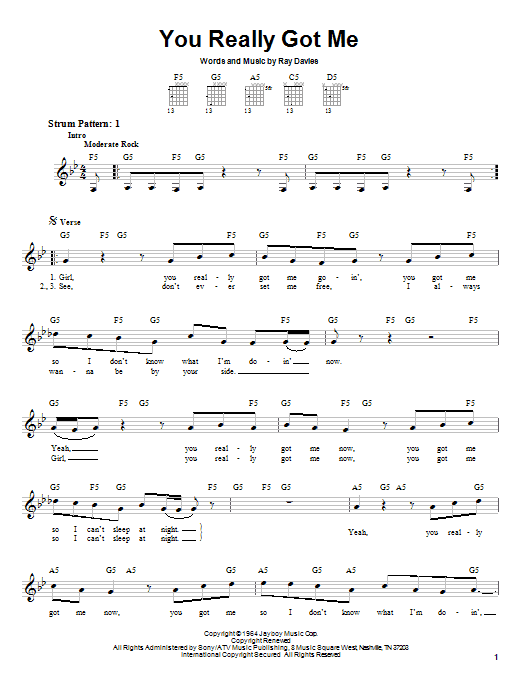 Produktgalerie: Seite 1 von 1 You Really Got Me, The Kinks, Gitarre