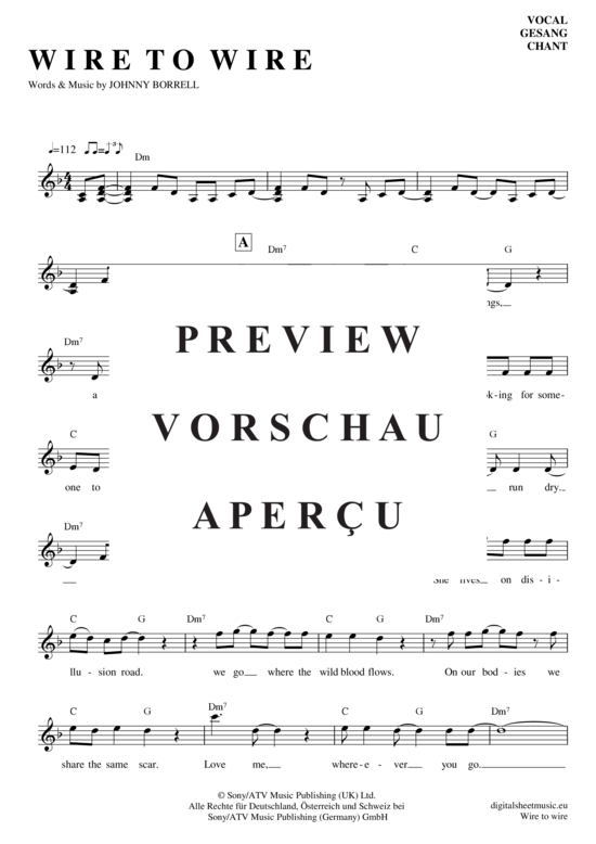 gallery: Wire to wire , Razorlight, (Gesang)